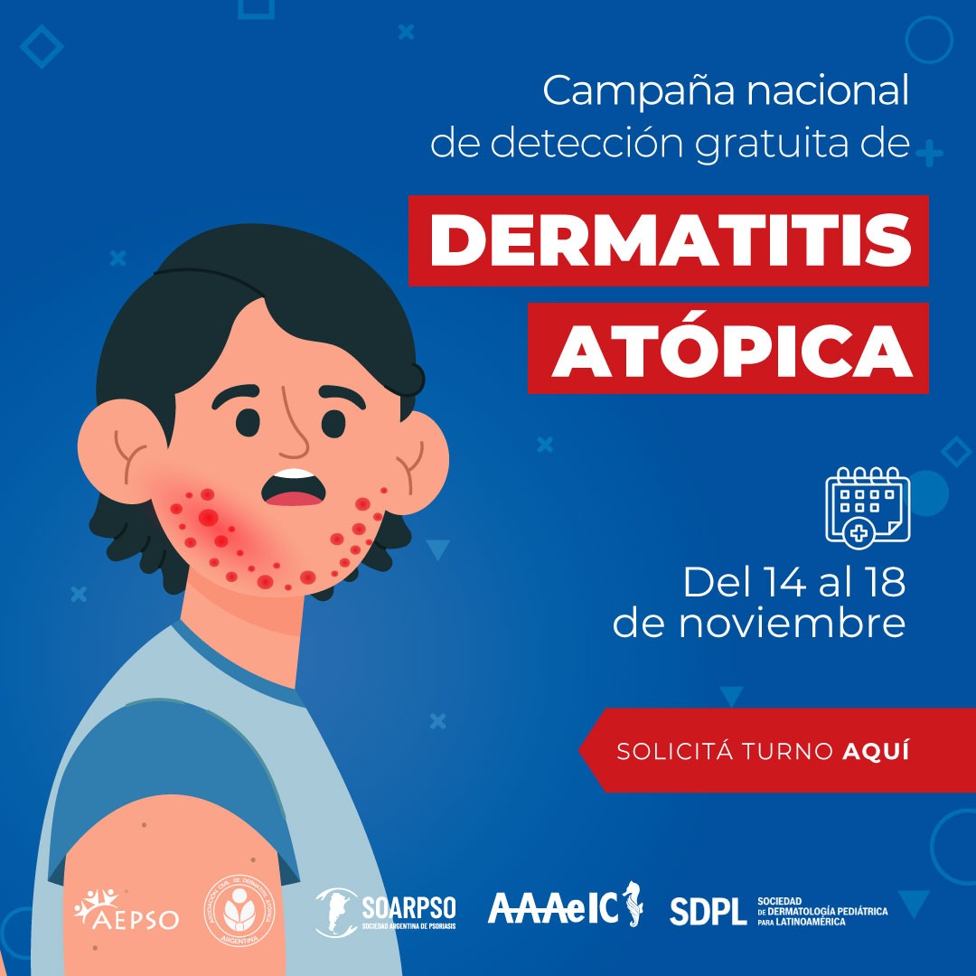 Campaña de Detección Temprana de Dermatitis Atópica 2022